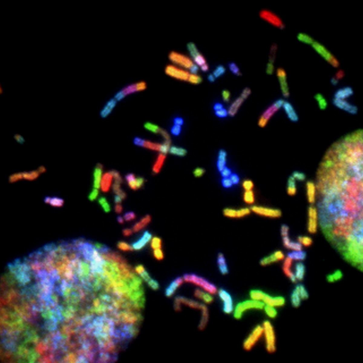 Coloured chromosomes prepared from a brain tumour, shown by spectral karyotyping.