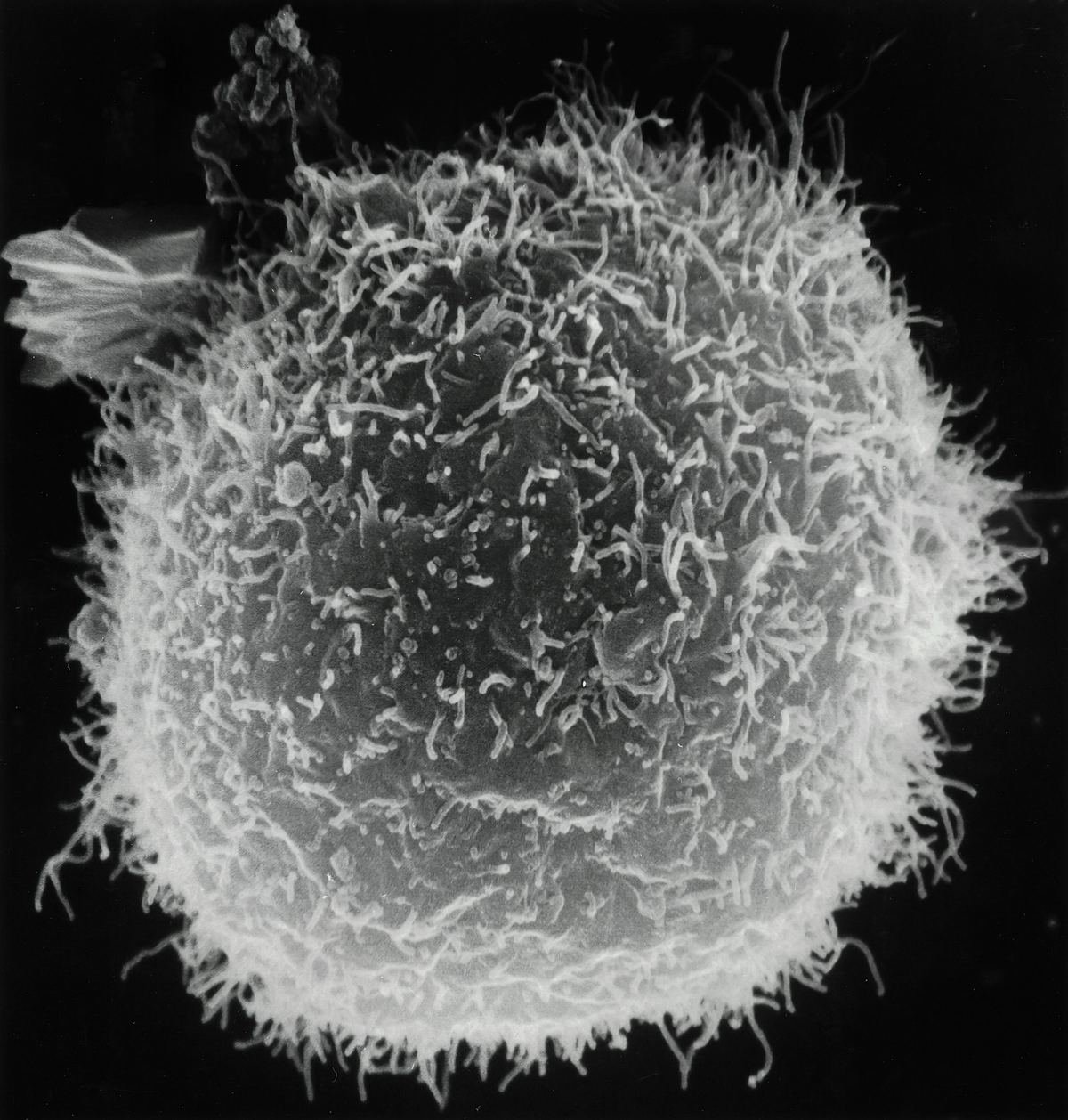 Electron micrograph of immune cells interacting with lymphocytes.