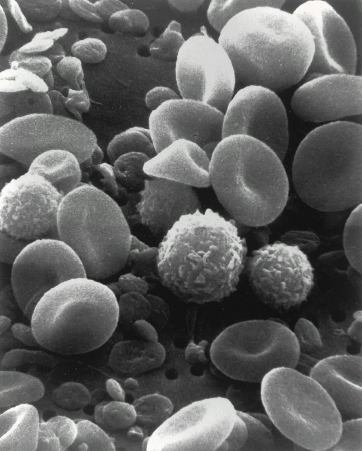 Electron micrograph of blood cells.