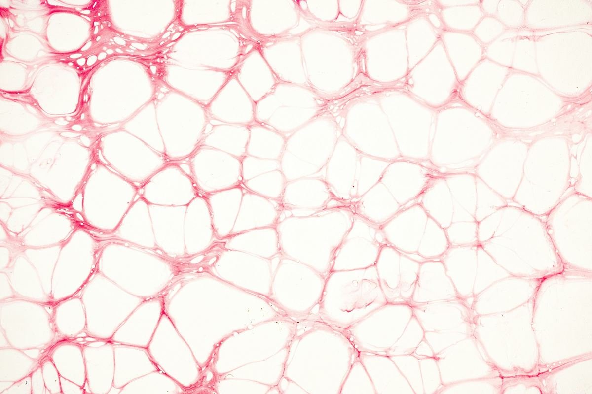 A fine network of pink cellular structures on a pale background.
