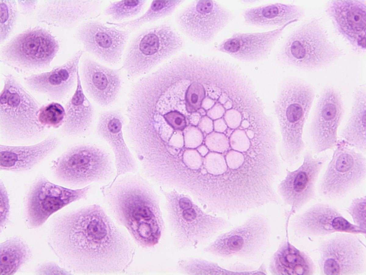 Microscope image of stained cells in shades of pink and violet.