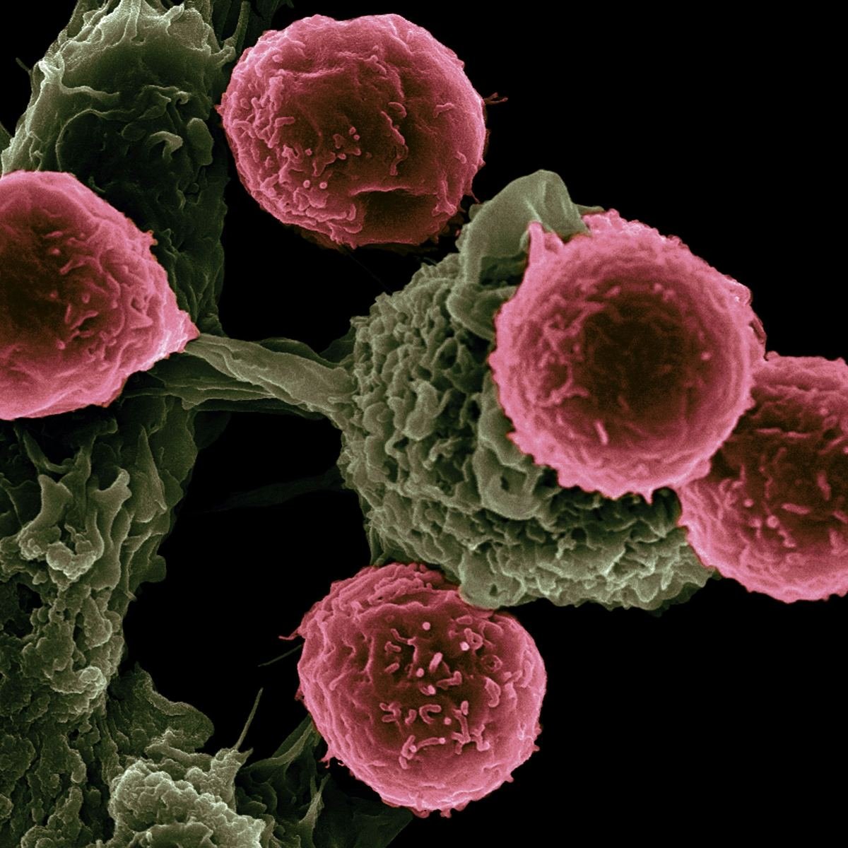 Microscope image of immune-therapy particles attached to cells.