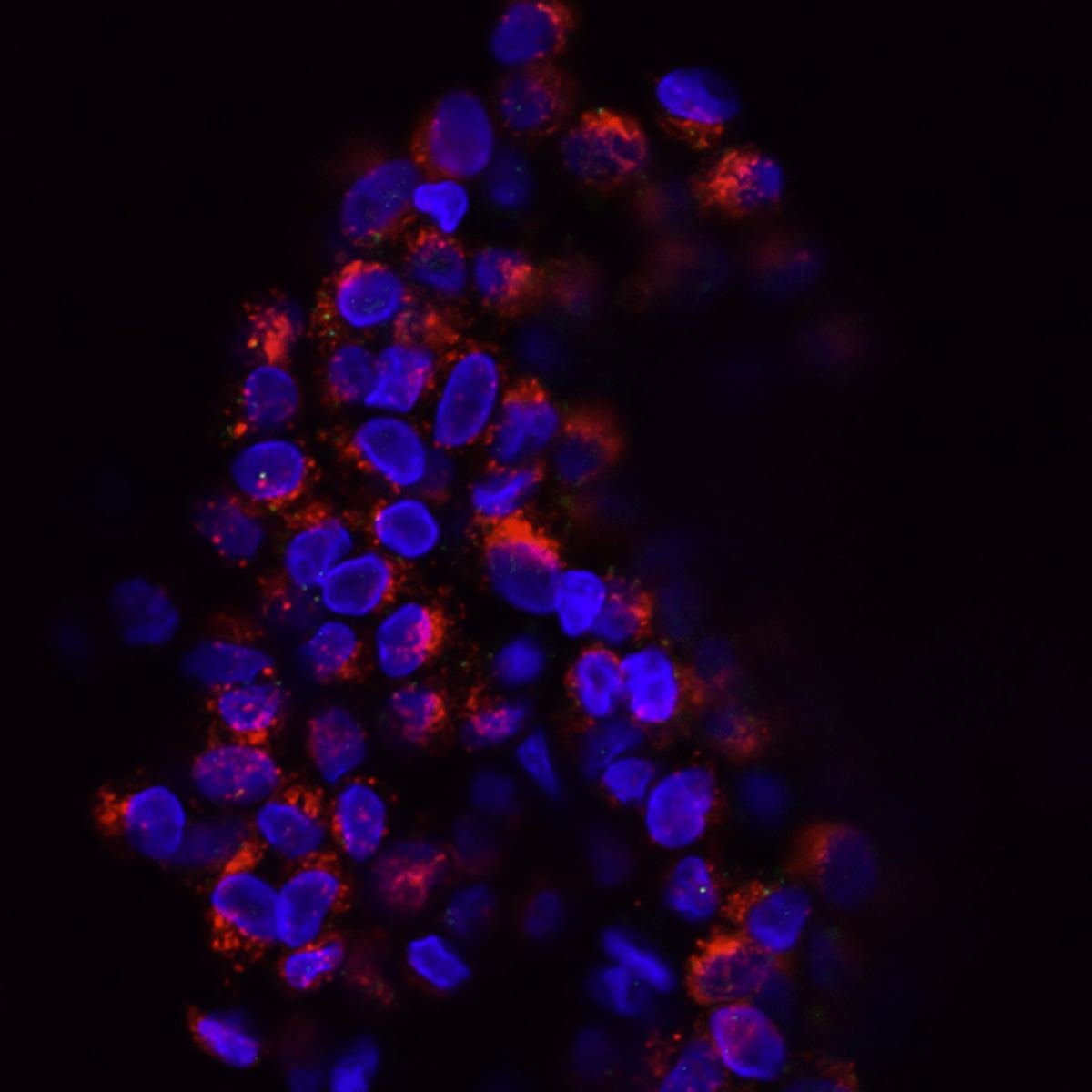 Fluorescent image of cancer cells circulating in the blood.