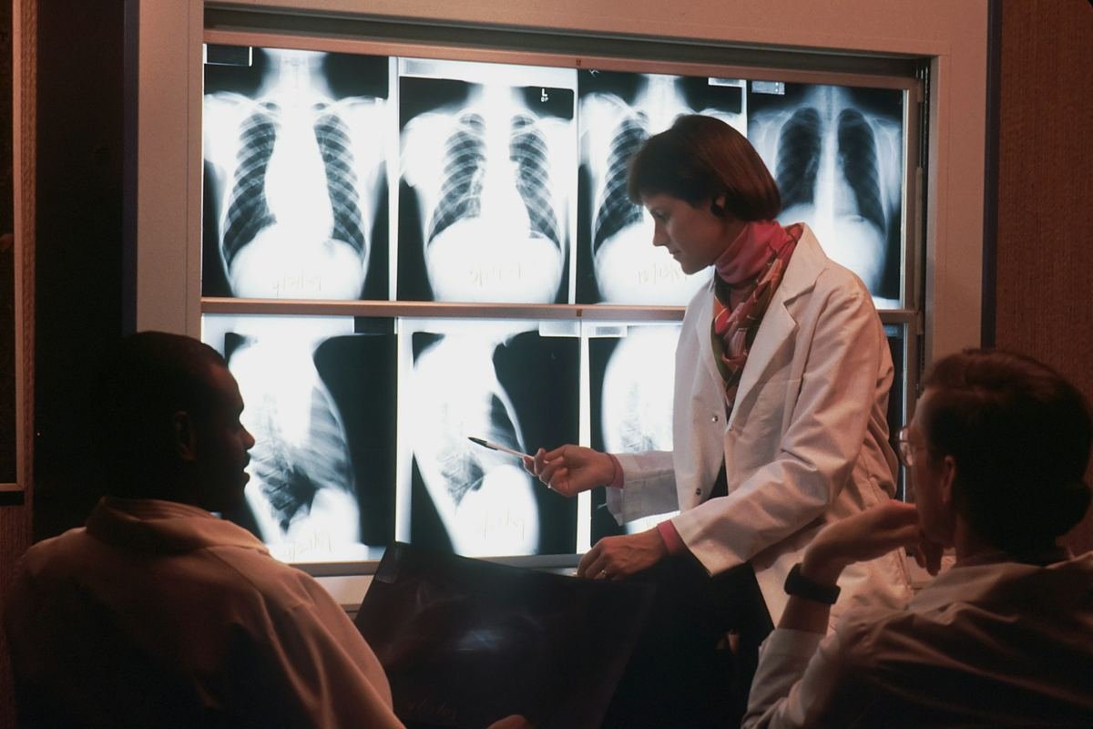 A doctor discussing chest X-rays displayed on light boxes.